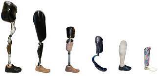 Artificial Limbs Market